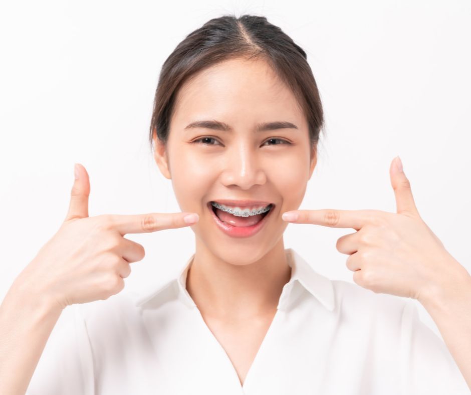 địa chỉ niềng răng uy tín ở Quảng Ngãi