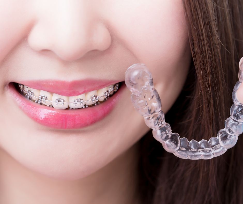 địa chỉ niềng răng uy tín ở quảng ngãi địa chỉ niềng răng uy tín ở Quảng Ngãi