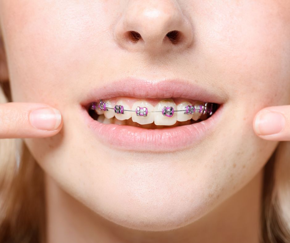 địa chỉ niềng răng uy tín ở quảng ngãi địa chỉ niềng răng uy tín ở Quảng Ngãi