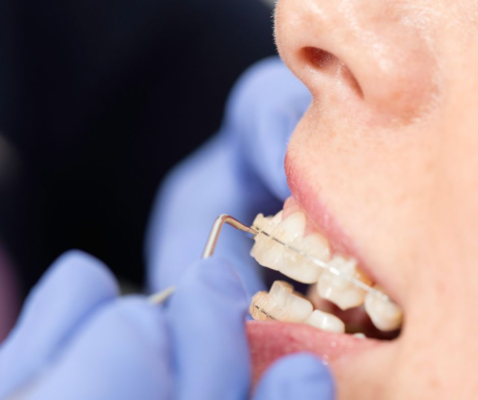 địa chỉ niềng răng uy tín ở quảng ngãi địa chỉ niềng răng uy tín ở Quảng Ngãi